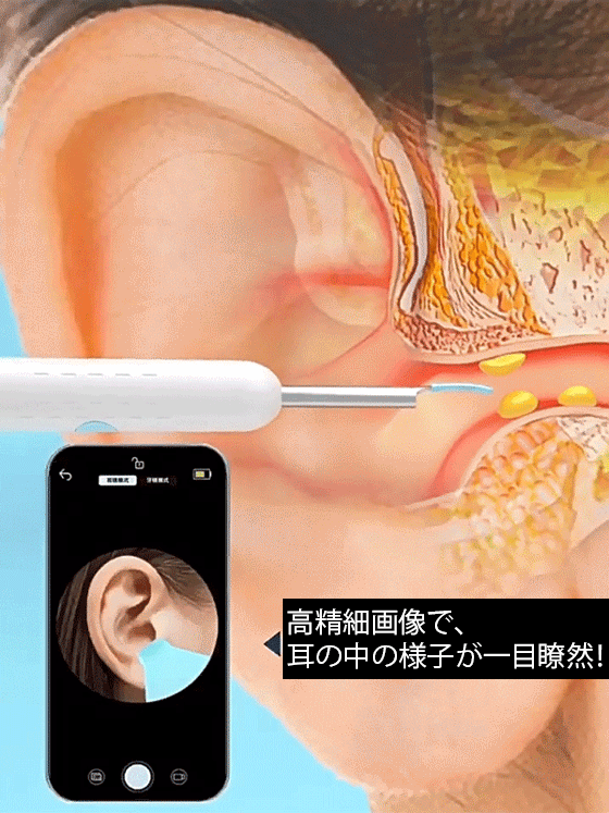 【スマホで耳の中が見える】カメラ付き耳かき