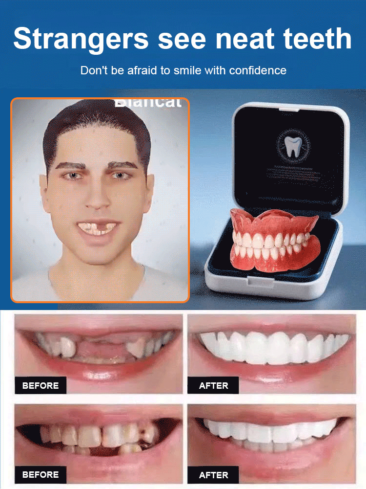 Silicone Simulation Teeth Braces