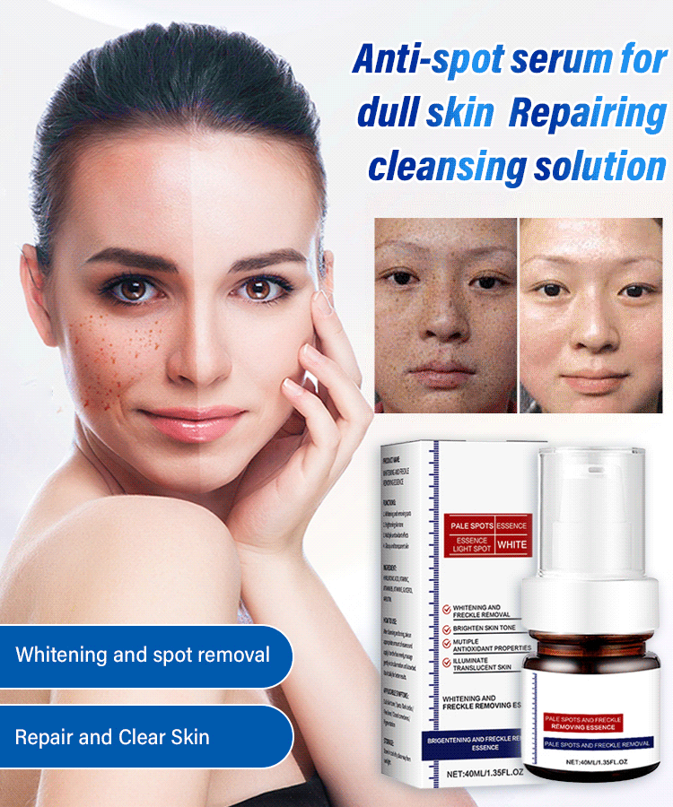 Freckle-Banishing Serum for Face: Repair and Cleanse Dark Spots