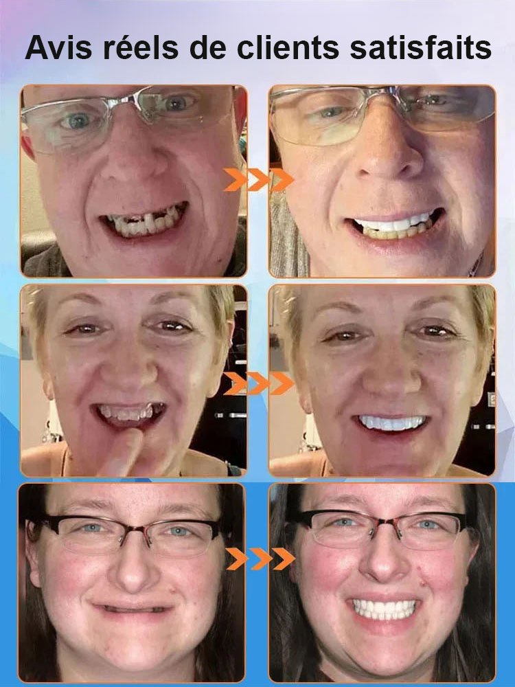 【Nouvelle découverte britannique】Appareil dentaire en silicone imitant les dents