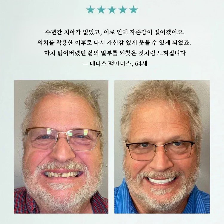 【3-in-1】미백 틀니 세트