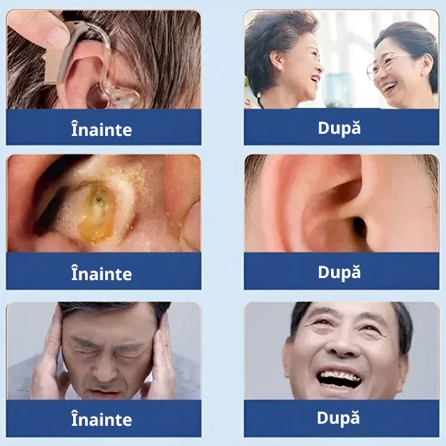 Îngrijire blândă pentru ameliorarea tinitusului