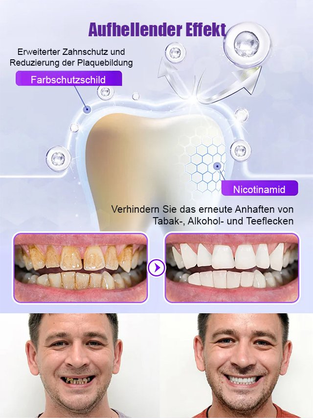 【Zahnpflege-Regeneration】Zahnreparatur und Aufhellung mit mineralischem Zahnpulver