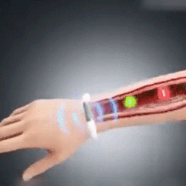 Bracelet intelligent de contrôle de la glycémie