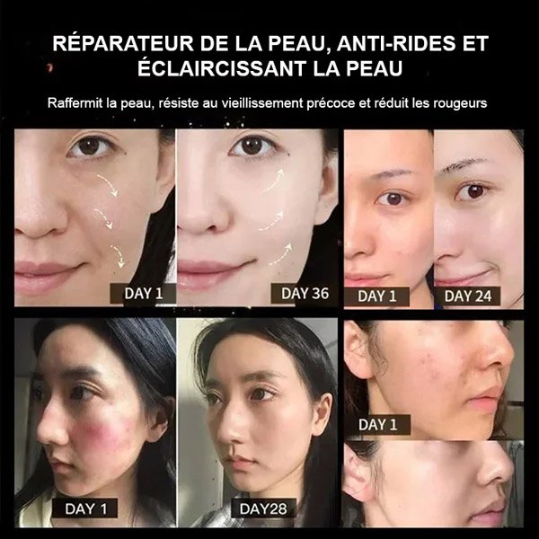 Crème de soin pour le visage au venin d'abeille