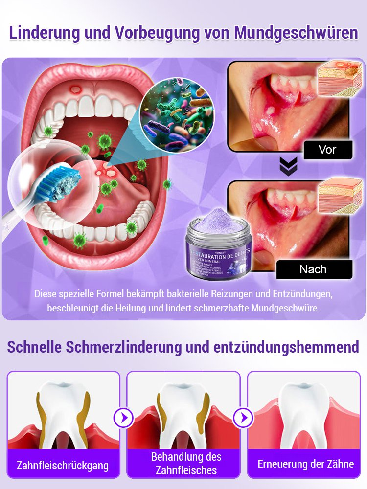 【Parodontale Gesundheit wiederherstellen】Zahnerneuerung lila Mineralzahnpulver