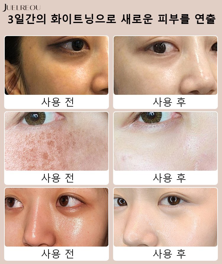 [피부 미백] 화이트닝 니코틴산 아미드 클렌징 폼! 국내 최초 피부 재생 유도형 미백 클렌징 폼, 세안 후 시각적 피부 밝기 2배 증가, 빈틈없는 화이트닝 효과!
