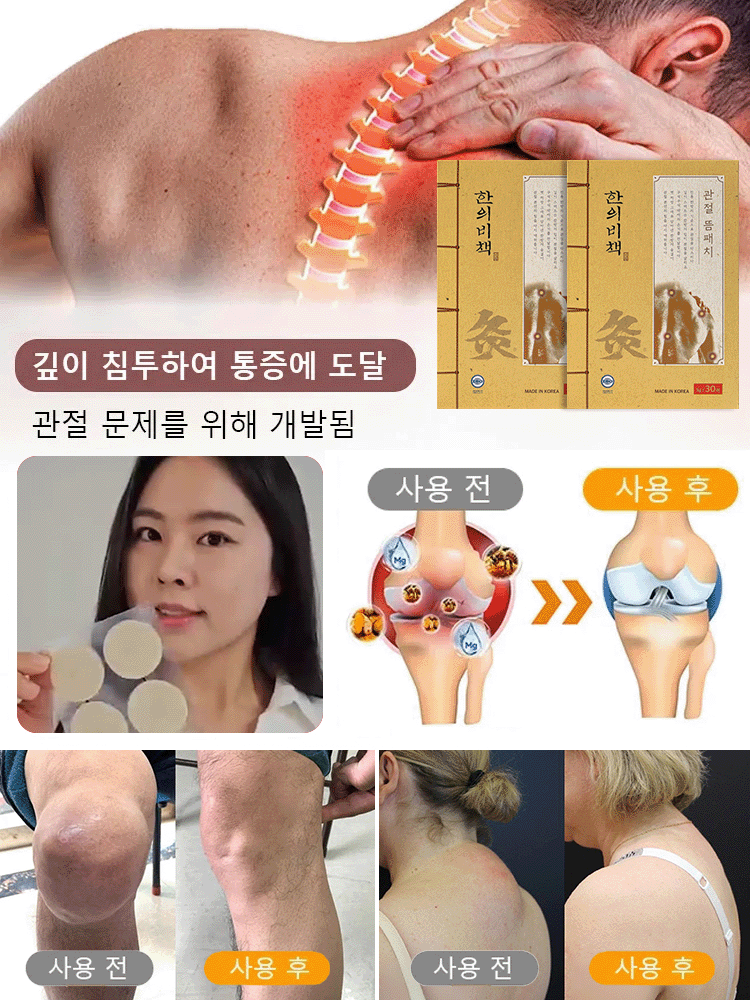 【전문적인 산성 마비 통증 치료】허브 관절 복원 패치