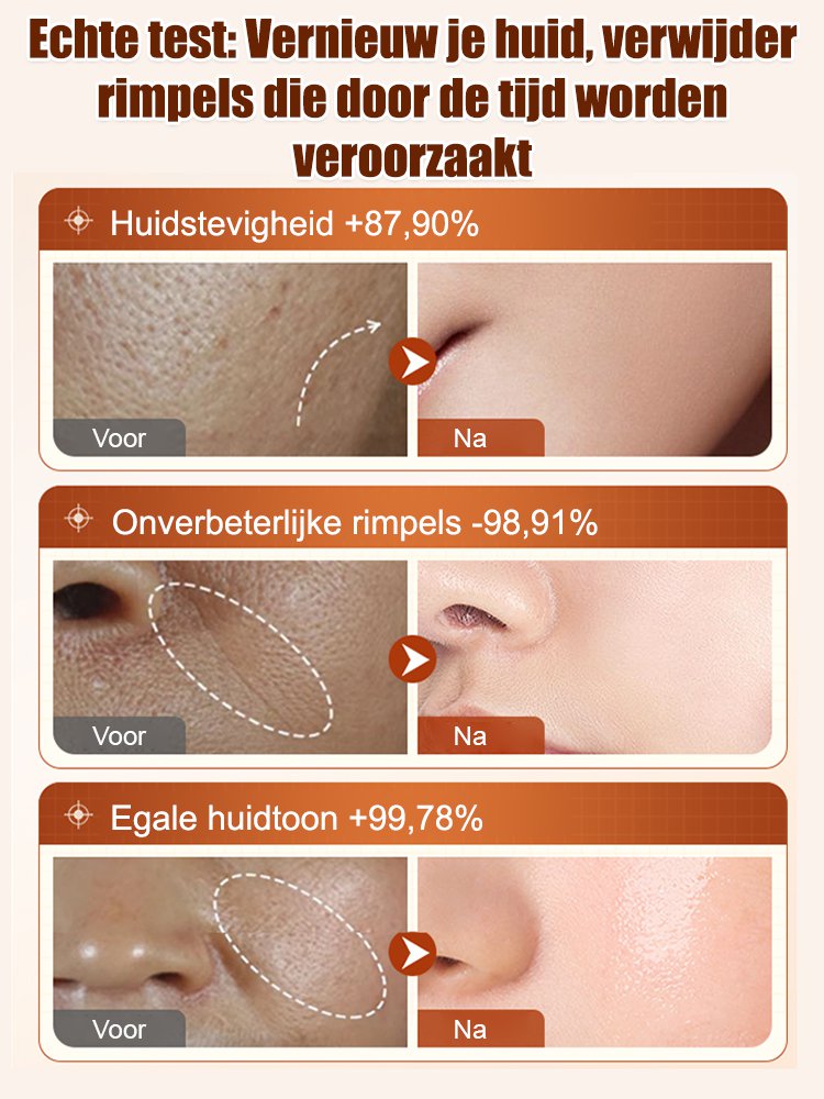 【Rimpelverwijdering in seconden】Ectoin anti-aging serum