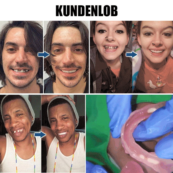 Zahnkosmetik-Prothesen-Verzierungssatz