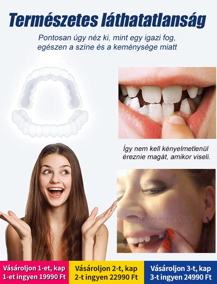 Állítható bepattintható műfogsor