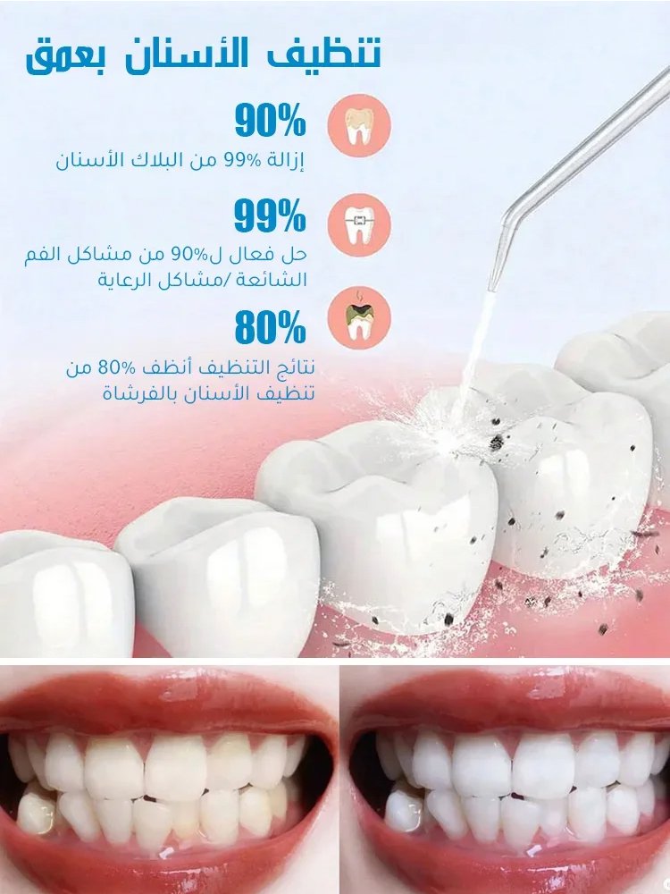 【موصى بها من الخبراء】فرشاة أسنان بتقنية النبض الحصرية + طقم جهاز تنظيف الأسنان بالماء