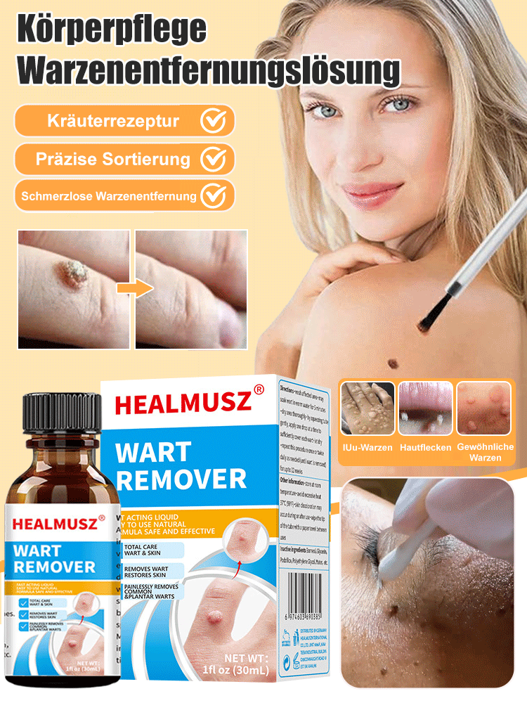 Körperpflege Warzenentfernungslösung