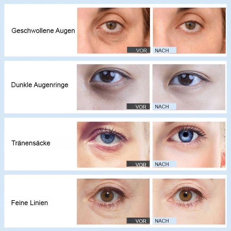 Straffender Retinol-Augenreparaturstift