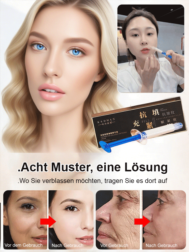 【Falten-weg Sofort】Peptid-Spritzen-Kollagen-Creme