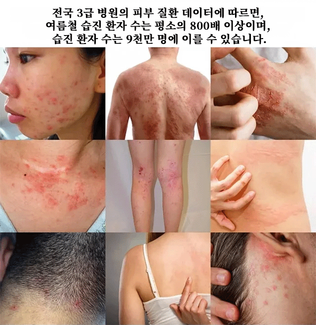 翻译件-X2022102703H-South-Moon紫花地丁皮肤止痒修护膏-wz_05.gif