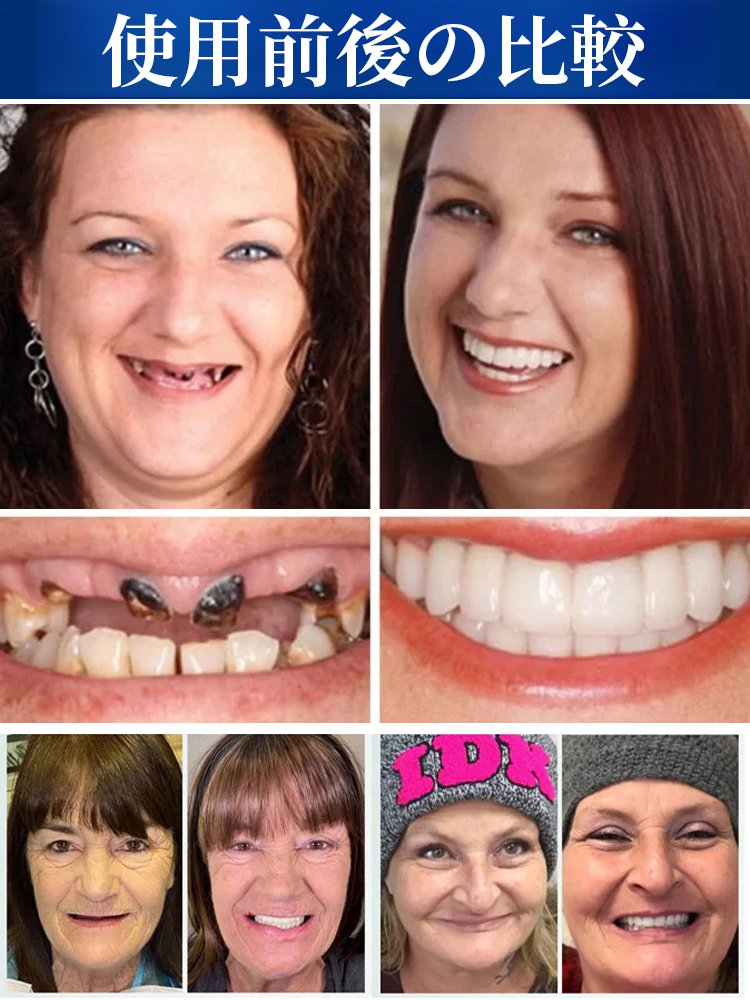 【FDA認証】完璧にフィット入れ歯セット