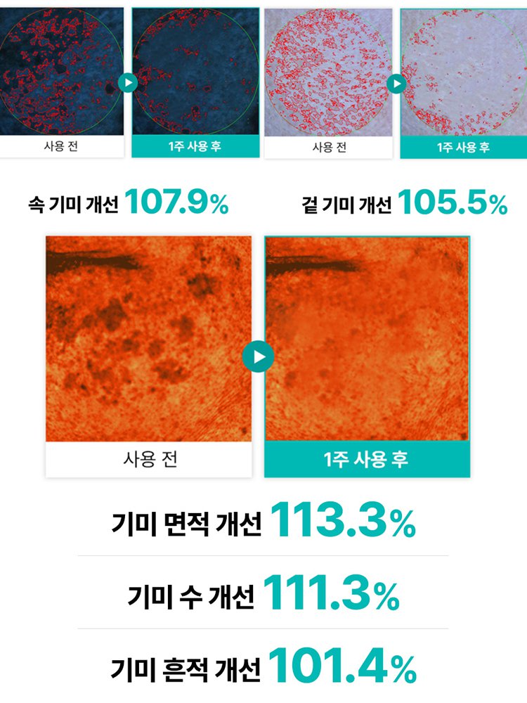 잡티 제거 및 미백 필오프 마스크