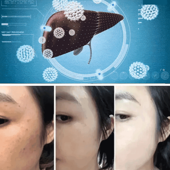 【Bescherming van de lever en verlaging van vet】Kudzu-wortel en reishi-paddenstoel tabletten