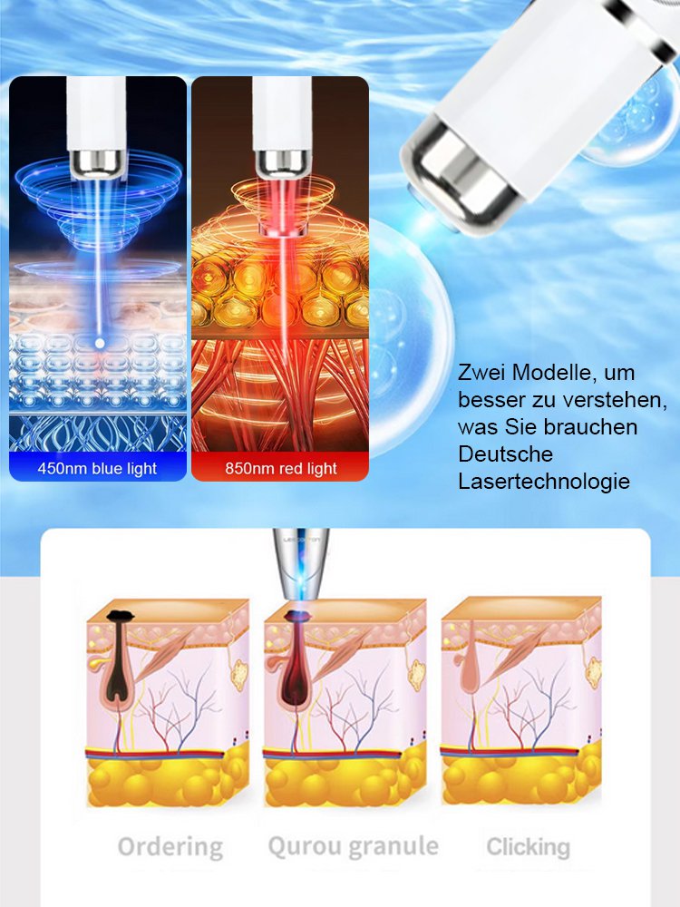 Laser-Schönheitsgerät