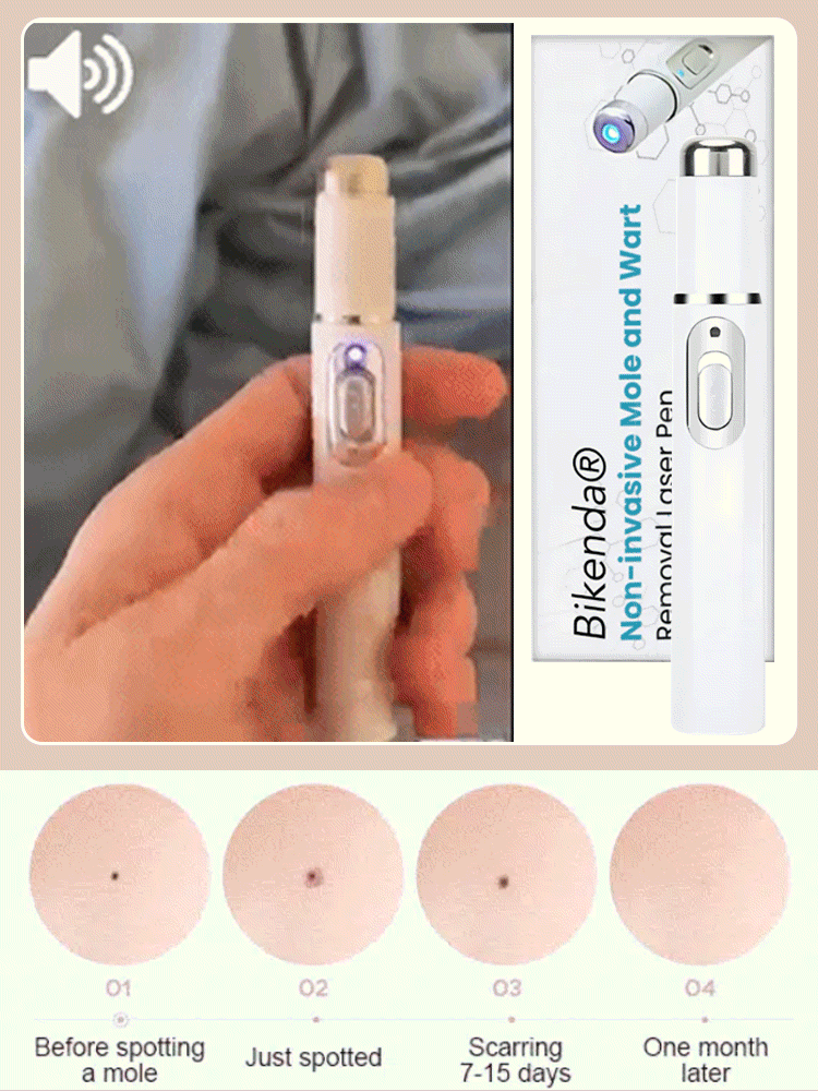 Laser-Schönheitsgerät