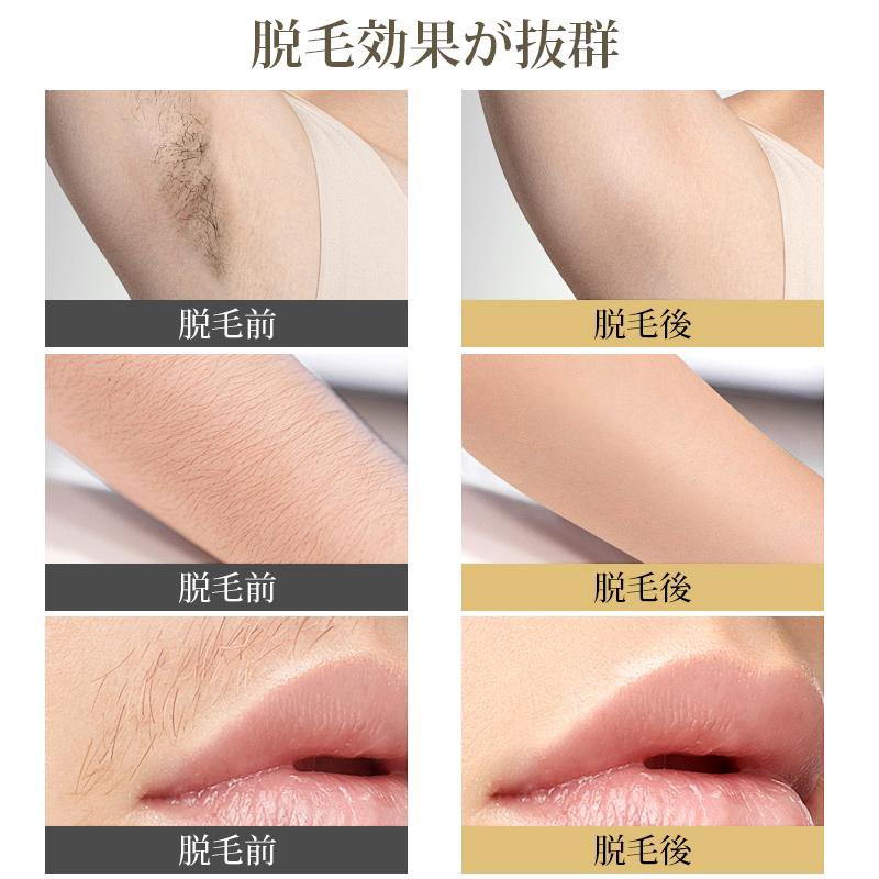 爆発式自動脱毛器