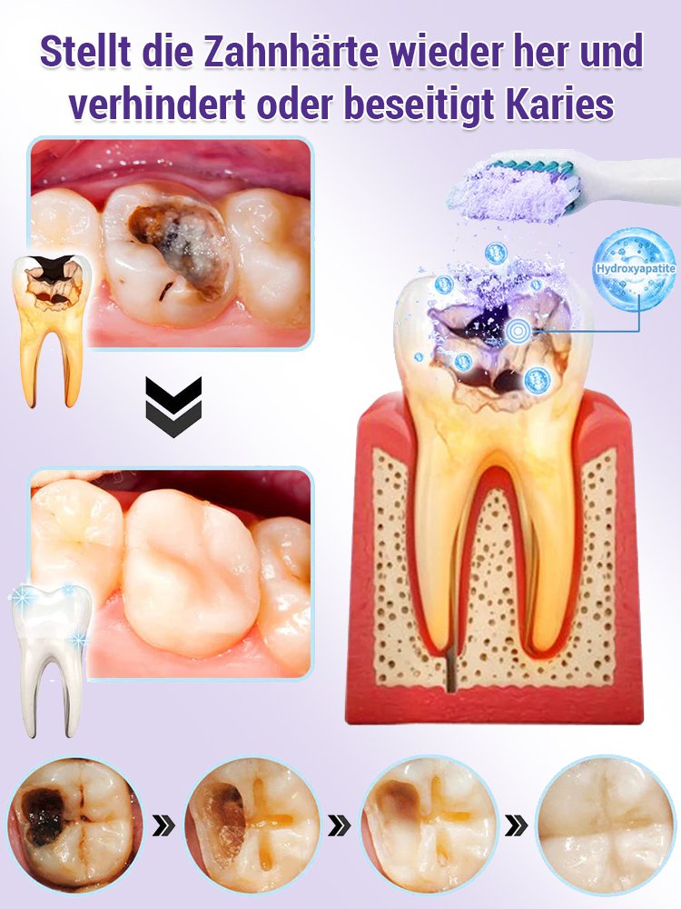 【Parodontale Gesundheit wiederherstellen】Zahnerneuerung lila Mineralzahnpulver