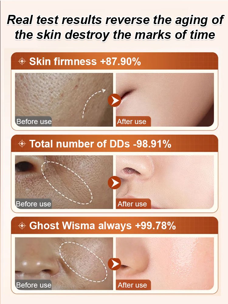 [Remove wrinkles in seconds] Ecdoin anti-aging essence