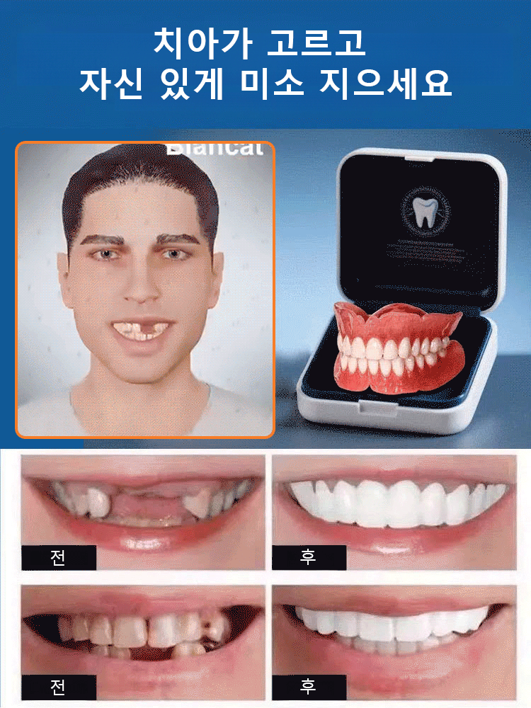 실리콘 모조 틀니