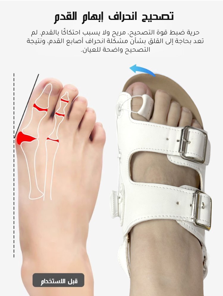 【براءة اختراع ألمانية】شبشب لتصحيح انحراف إبهام القدم