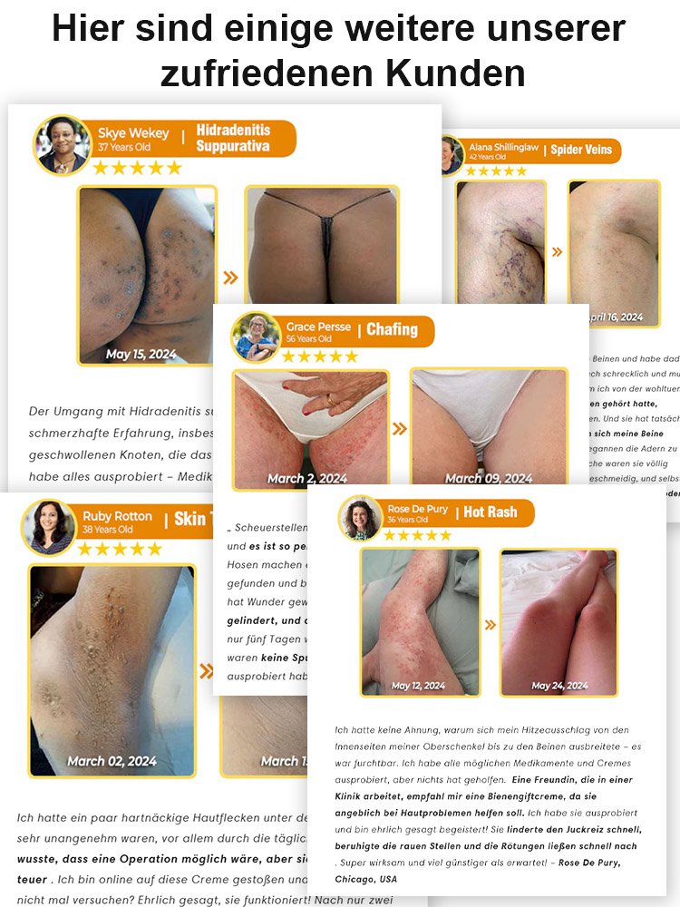 Bienengift Körperpflegesalbe