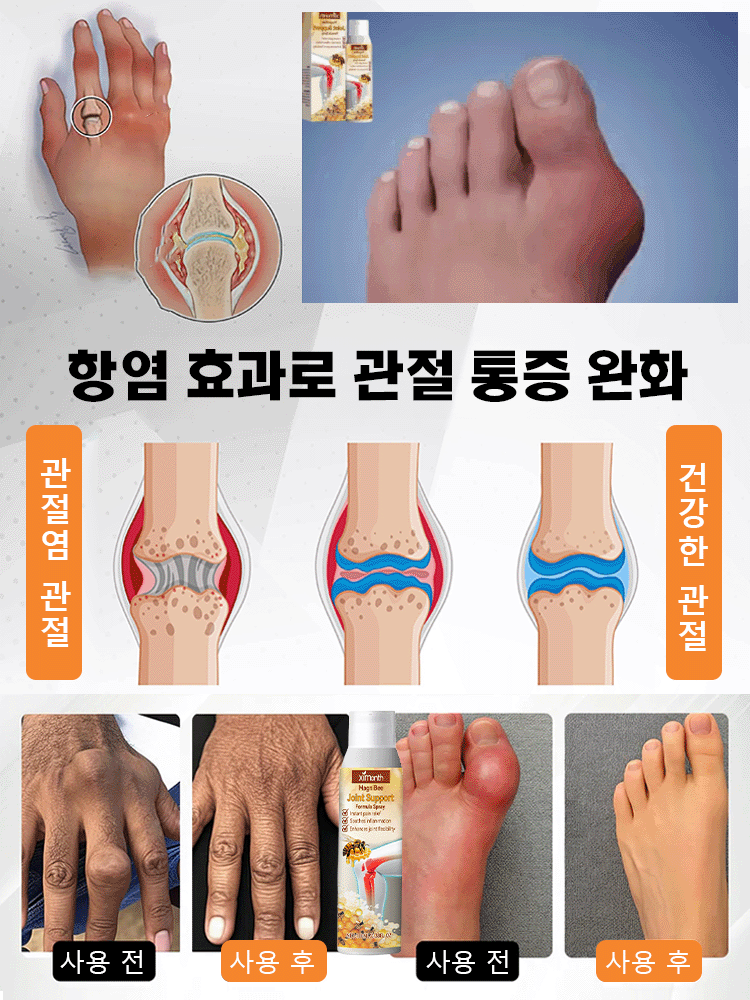 【붓기·통증 케어】 관절 관리 스프레이
