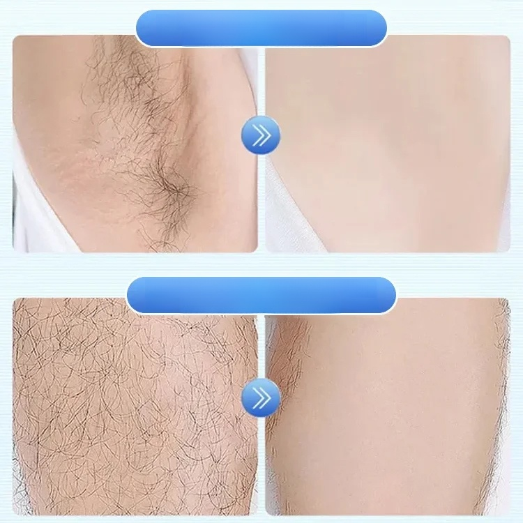 Rotary double ring electric shaver