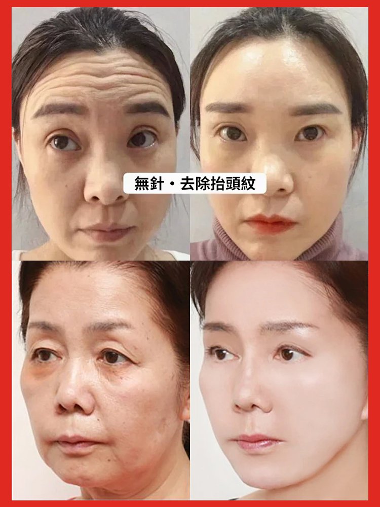 鮭魚水光抗皺精華液