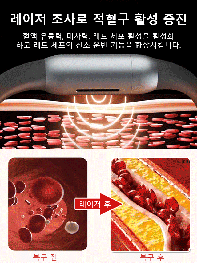 혈당 조절 스마트 팔찌
