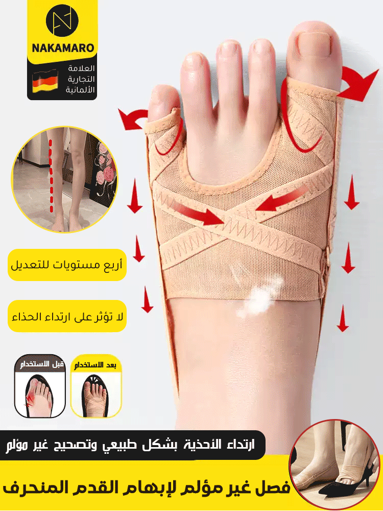 مصحح إبهام القدم الألماني بدون تدخل جراحي