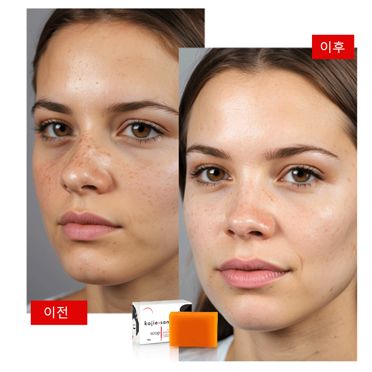 코직산 화이트닝 비누