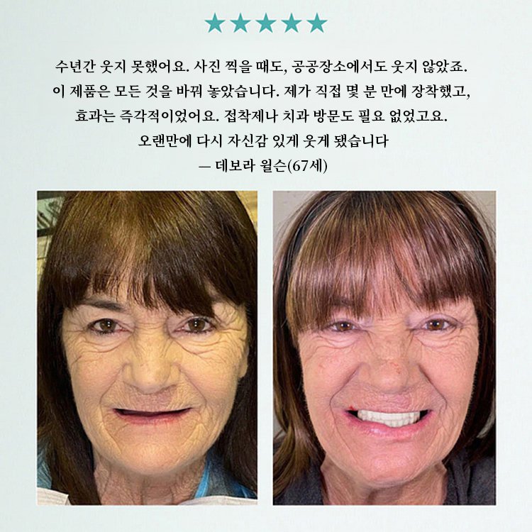 【3-in-1】미백 틀니 세트