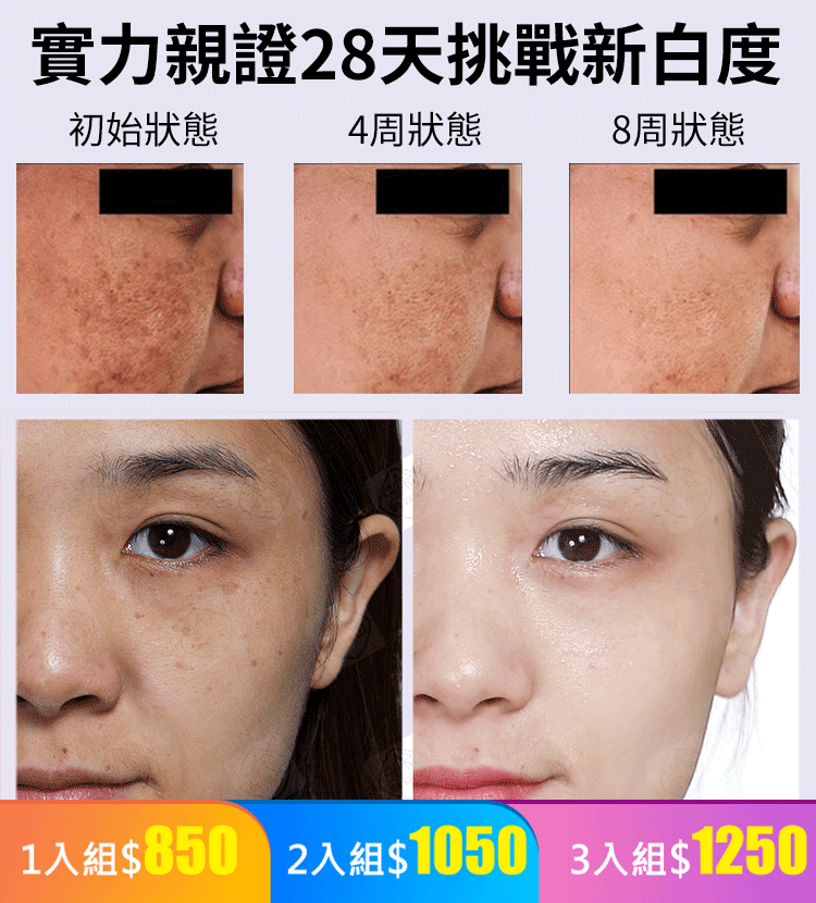 【老斑一夜斷】頂級美白祛斑王