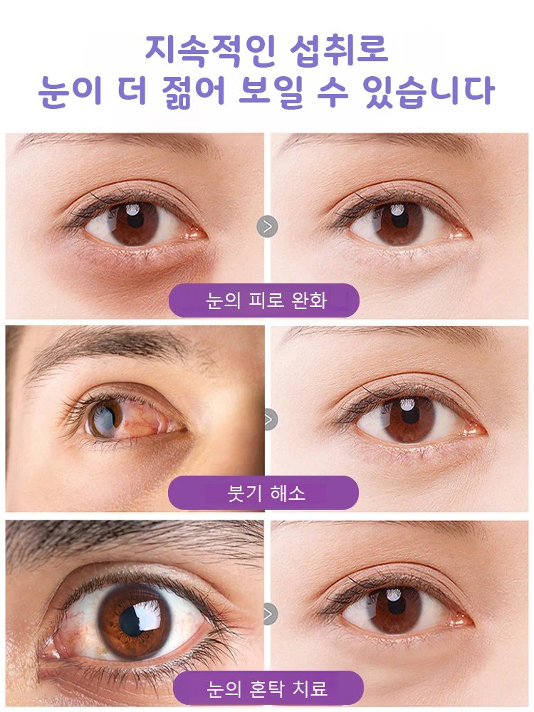 다품종 블루베리 씨앗