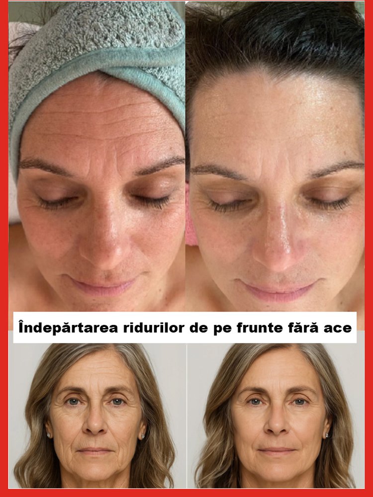 Serum de somon cu apă anti-riduri