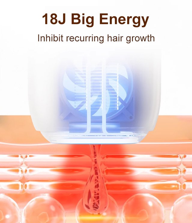 Home Laser Hair Removal