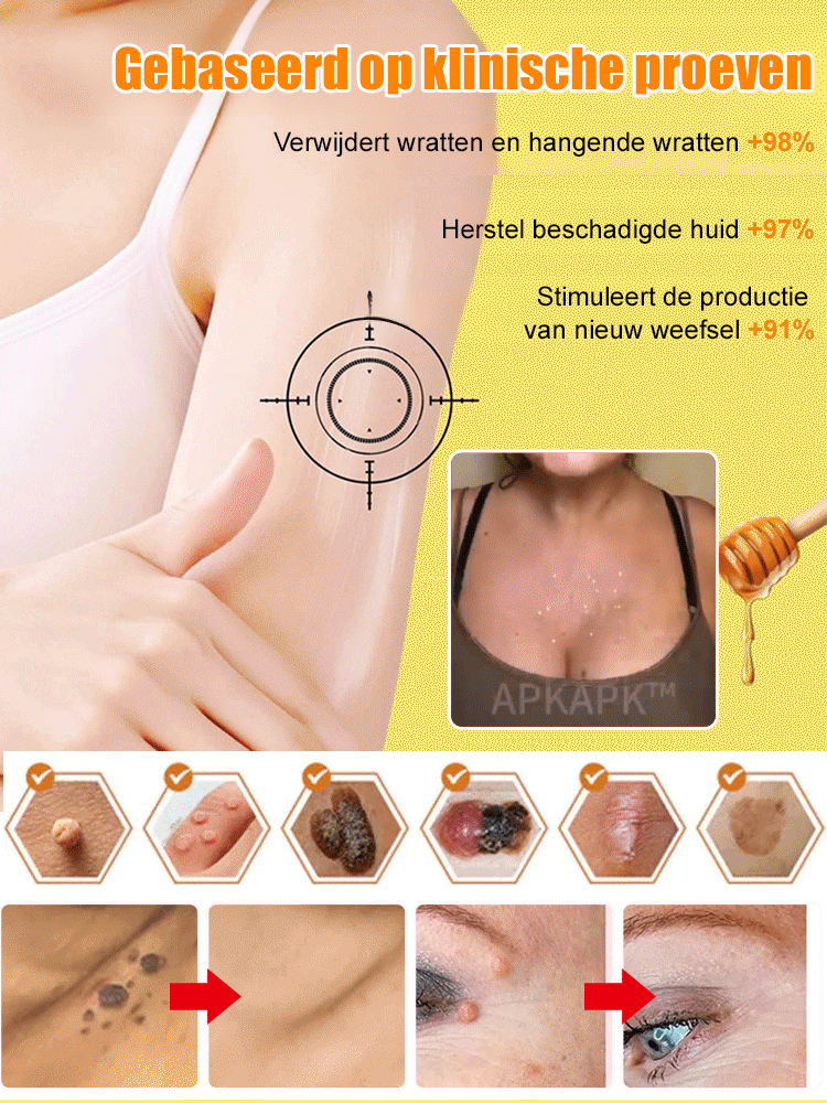 Bijengif uitgebreide verzorgingscrème