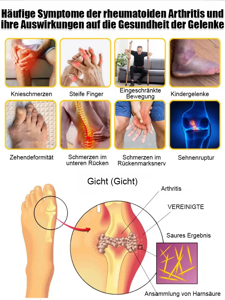 Bienengift schmerzlindernde Knochenheilungskreme