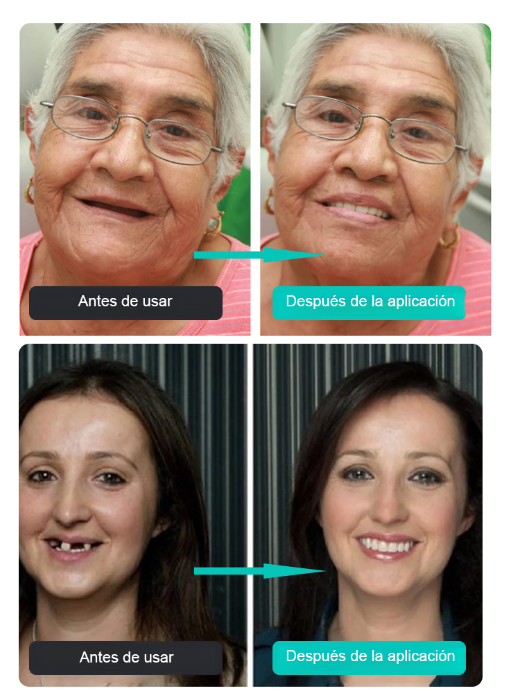 【Nowe odkrycie brytyjskich naukowców】Proteza zębowa z silikonu