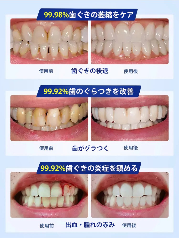 【有名な歯科医推薦】ハイドロキシアパタイト歯用保護液