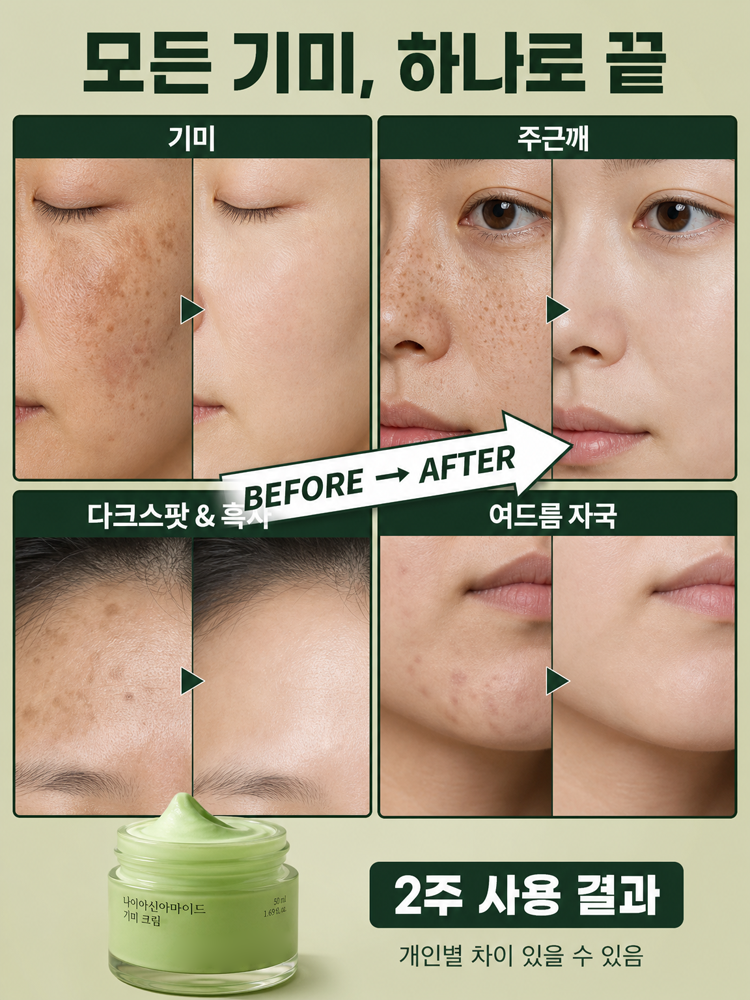 기미 케어 미백 크림