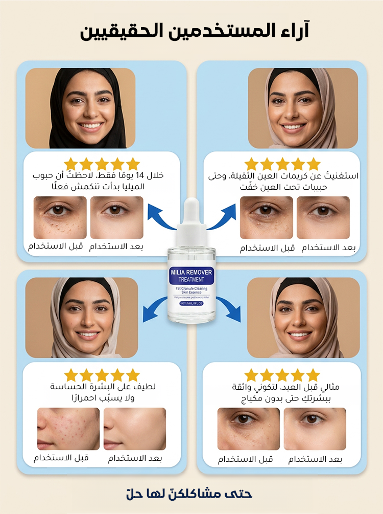 سيروم للعناية بحبوب الميليا حول العينين