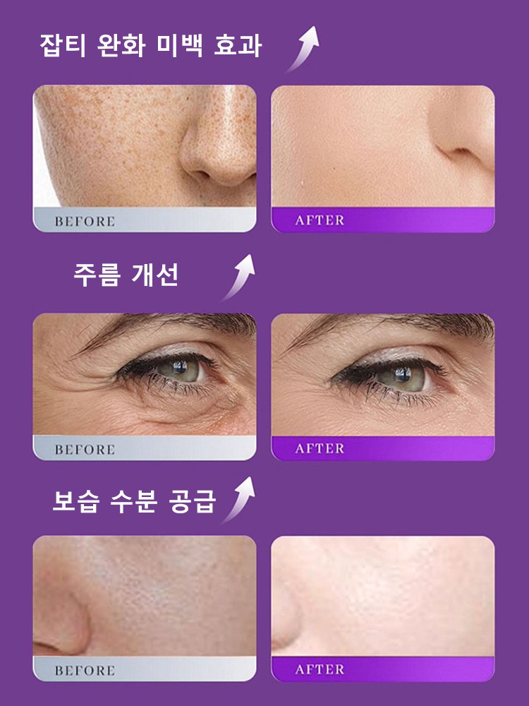 화이트닝 주름개선 에센스【 7일 동안 잡티 완화 미백】