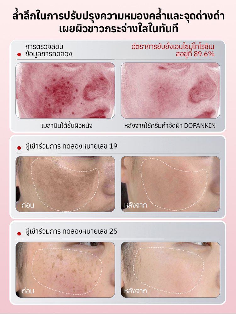 ประสิทธิภาพสูงในการทำให้ผิวขาวด้วยกลูตาไธโอนเสริม